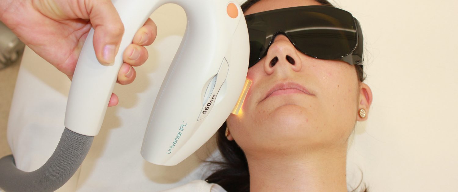 PHOTOREJUVENATION WITH INTENSE PULSED LIGHT IPL LUMENIS M22 | Concept ...